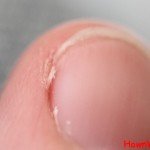 How to Prevent Hangnails