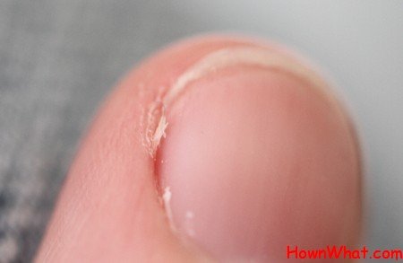 How to Prevent Hangnails