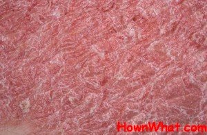 How to Get Rid of Psoriasis