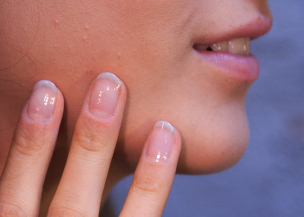 How to Strengthen Weak Nails Naturally